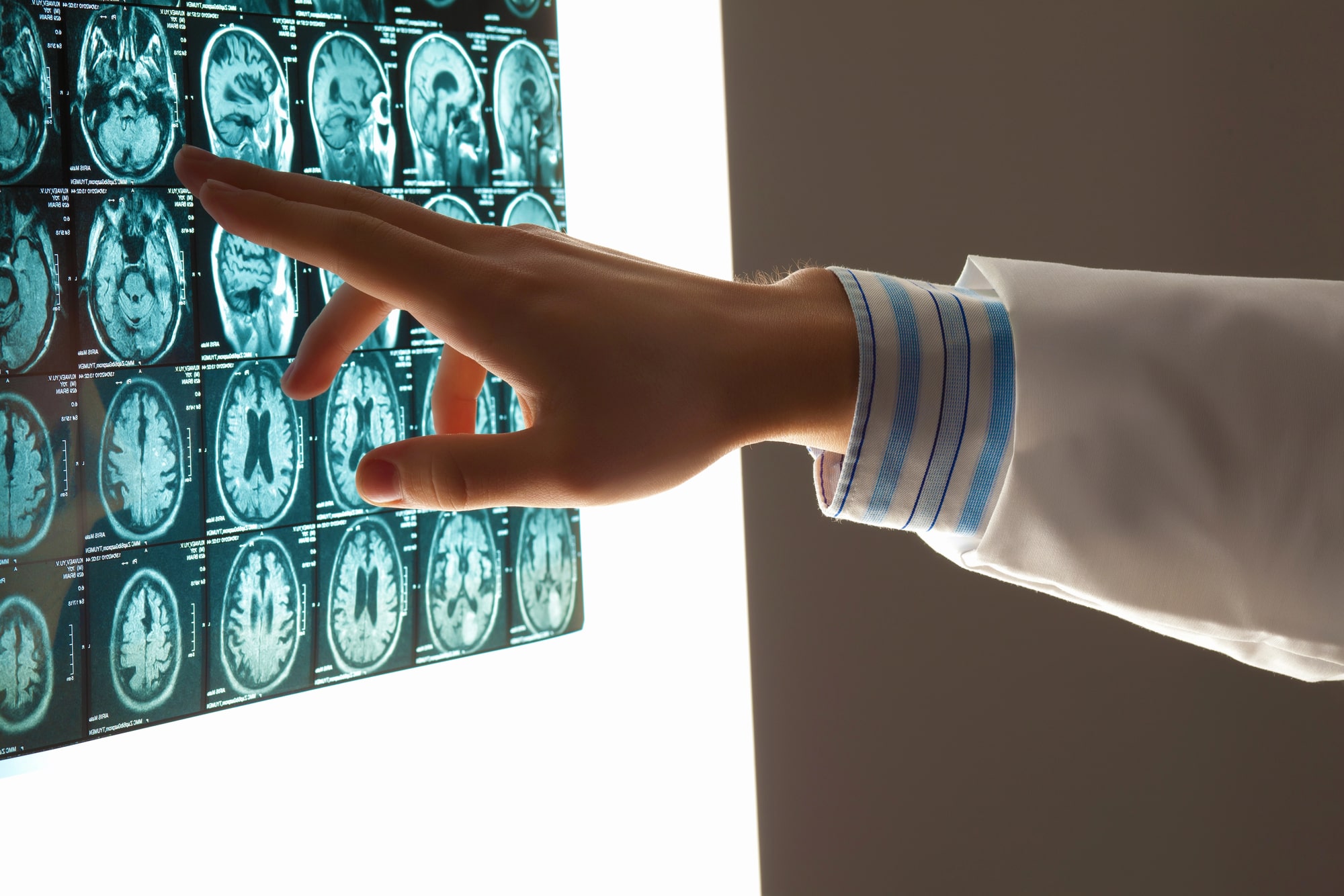 pringfield, IL Brain Injury Lawyer