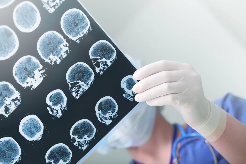 brain injury lawyer Maryland Heights, MO